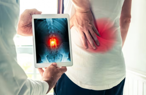 El aumento de peso incrementa el riesgo de dolor lumbar