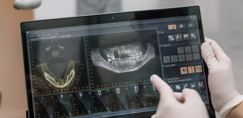 Por qué los implantes se han convertido en el tratamiento con más crecimiento en Madrid